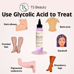 TS Beauty glycolic acid bottle placed beside icons showing skin benefits


